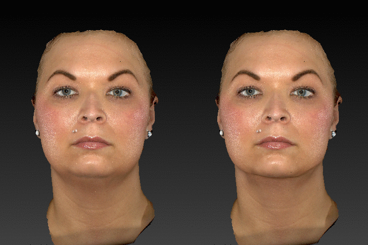 3D and Video Imaging at the Hilger Face Center