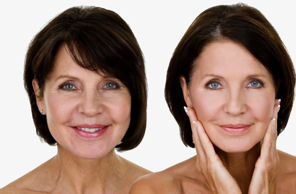 Hilger Face Center Facial Rejuvenation service Minneapolis and Edina